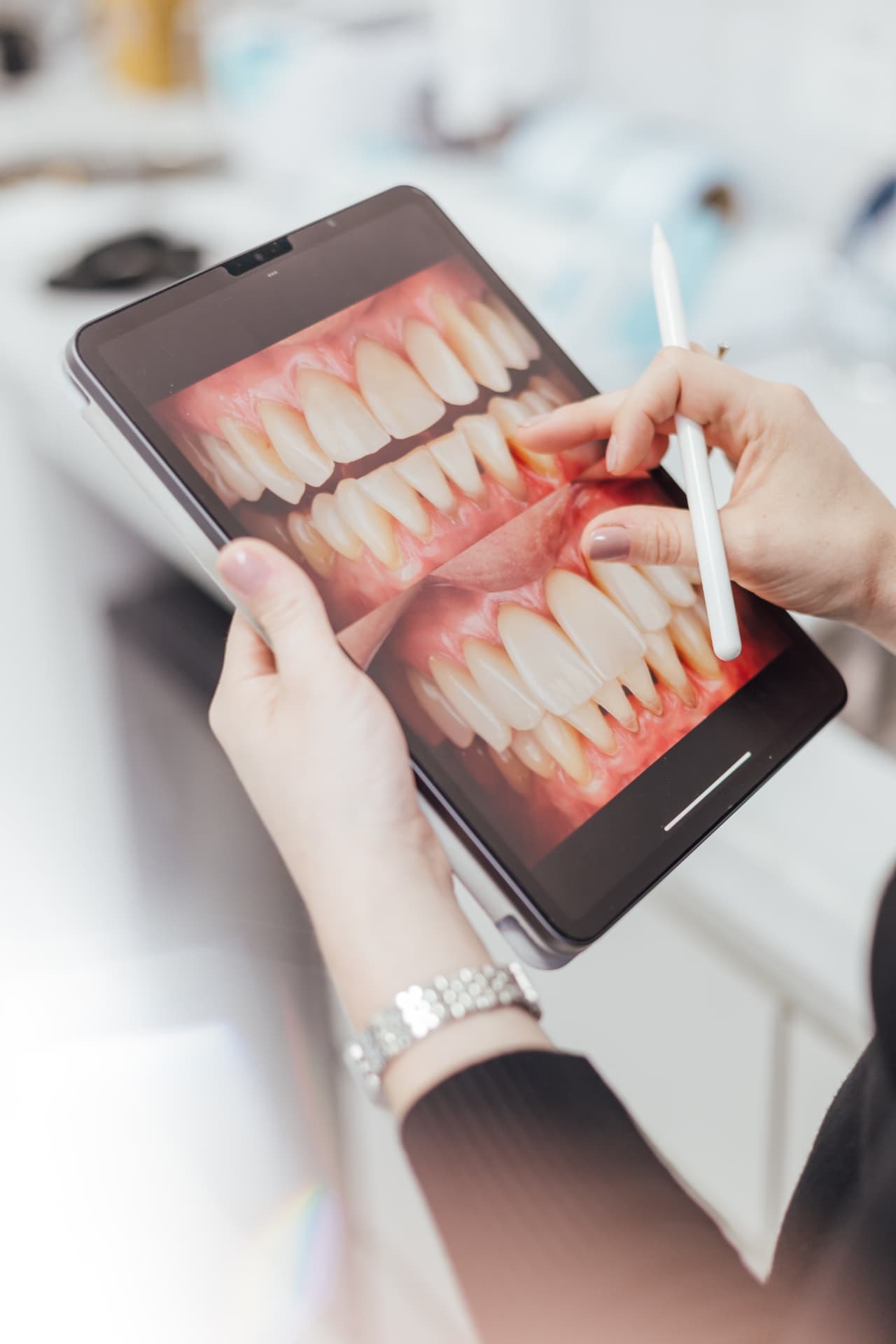 Planejamento digital do sorriso em tablet
